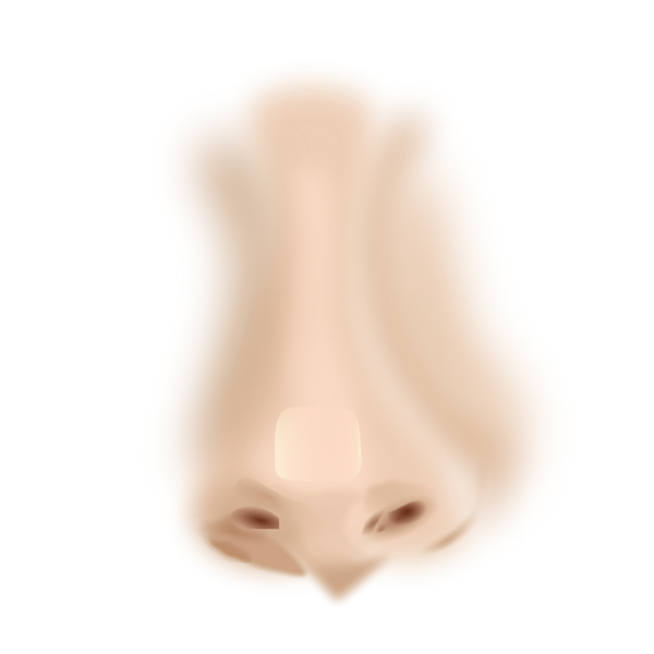 隆鼻重修-鼻頭正方形